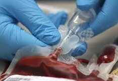 Transfusion sanguin e1668003188813