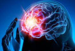 medecine cerebrale e1670838196707