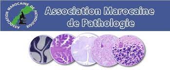 La pathologie digitale au centre des débats du 5ème Congrès national de l'Association marocaine de pathologie, les 10 et 11 février à Salé 1 Association marocaine de pathologie