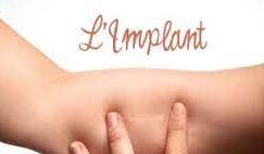 Implant sous cutane 1 e1676035083548