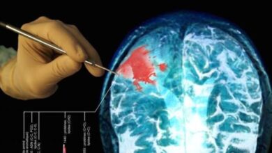 1505039327cancer tumeur cerveau sonde invention quebecoise Ux1bdvs