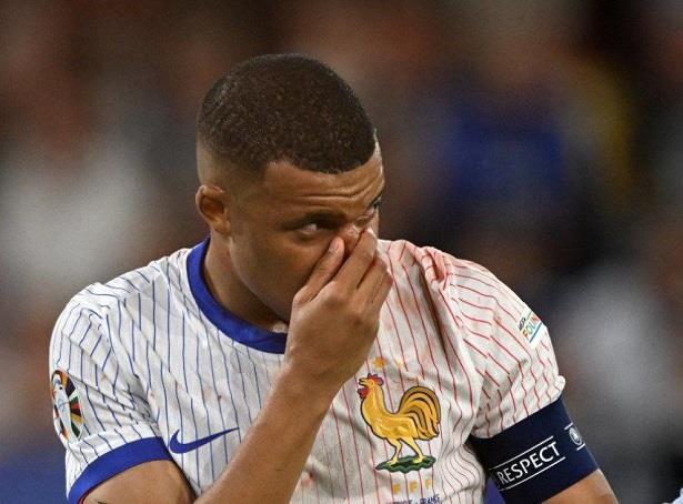 Euro-2024: Mbappé ne subira pas d'intervention chirurgicale 1 vis 0618202410042901