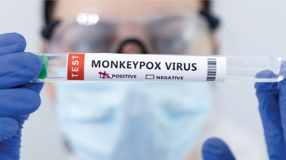 Afrique du Sud : 7 infections à la variole du singe 1 vis 0825202214031182