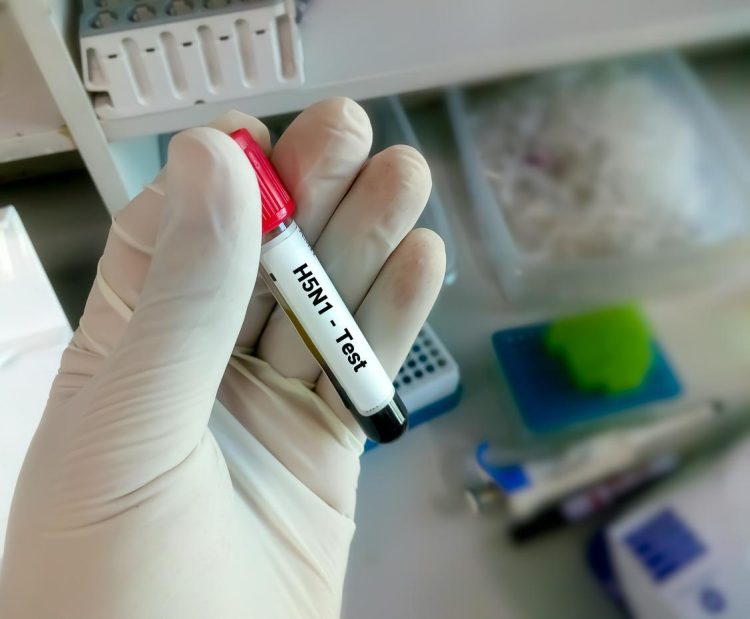 Grippe aviaire: l’OMS envisage des vaccins à ARNm 1 H5N1 e1722240396611