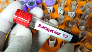 monkeypox2 750