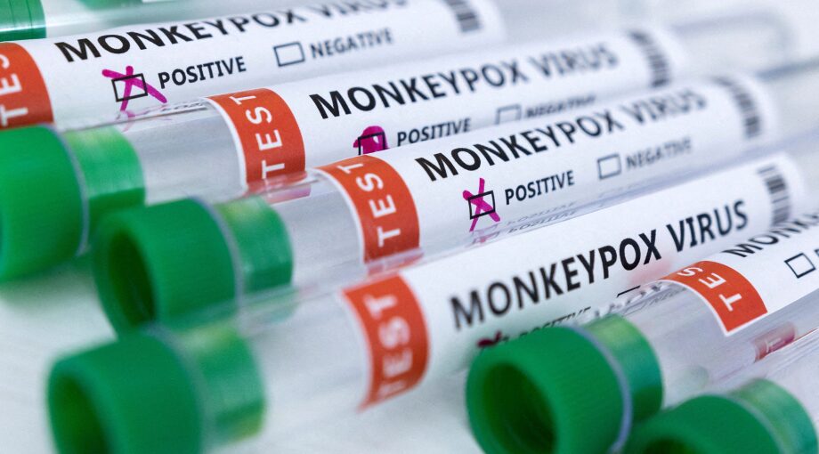 Variole du singe : 4 cas confirmés au Rwanda 1 vis 0817202413002159