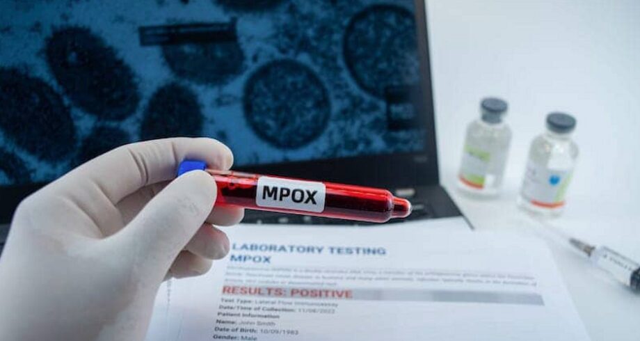 Mpox : L'OMS déplore le manque de tests en RCD 1 vis 0915202410272502