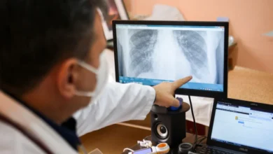 Royaume-Uni:l’IA au service du diagnostic précoce du cancer du poumon